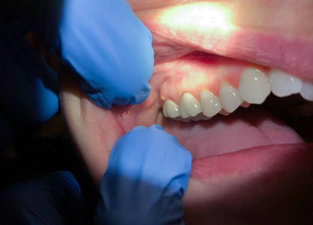 Best 24-Hour Emergency Dental Care in Scottville, MI